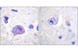 Immunohistochemistry analysis of paraffin-embedded human brain tissue, using HRS (Ab-334) Antibody. (HRS (HRS) (AA 301-350) anticorps)