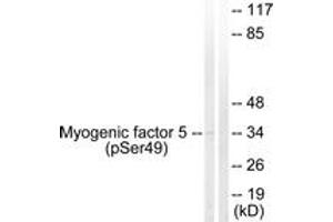 Western blot analysis of extracts from HeLa cells, using Myogenic Factor 5 (Phospho-Ser49) Antibody. (MYF5 anticorps  (pSer49))