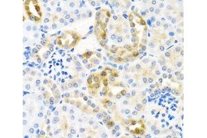 Immunohistochemistry of paraffin-embedded Mouse kidney using CST4 Polyclonal Antibody at dilution of 1:100 (40x lens). (CST4 anticorps)