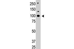 Western blot analysis of CBLC polyclonal antibody  in HL-60 cell lysate. (CBLC anticorps  (C-Term))