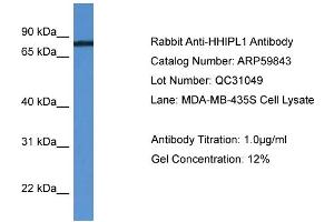 WB Suggested Anti-HHIPL1  Antibody Titration: 0. (HHIPL1 anticorps  (C-Term))