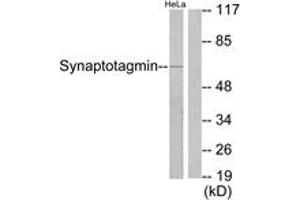 Western Blotting (WB) image for anti-Synaptotagmin (SYT) (AA 176-225) antibody (ABIN2888581) (Synaptotagmin anticorps  (AA 176-225))