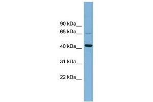 WB Suggested Anti-UEVLD  Antibody Titration: 0. (UEVLD anticorps  (Middle Region))