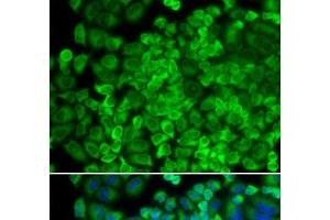 Immunofluorescence analysis of HeLa cells using GLA Polyclonal Antibody (GLA anticorps)