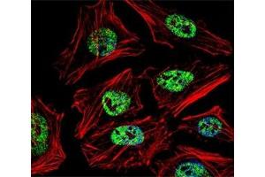 Fluorescent confocal image of HeLa cell stained with NANOG antibody at 1:25.