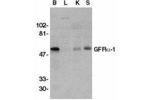 Western Blotting (WB) image for anti-GDNF Family Receptor alpha 1 (GFRA1) antibody (ABIN2473776) (GFRA1 anticorps)