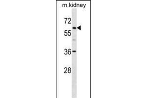 TFE3 Antibody (C-term) (ABIN1537398 and ABIN2849813) western blot analysis in mouse kidney tissue lysates (35 μg/lane). (TFE3 anticorps  (C-Term))