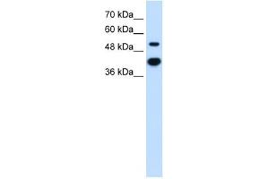 MMP1 antibody used at 2. (MMP1 anticorps)