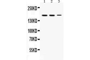 Western blot analysis of KDM5B expression in rat testis extract ( Lane 1), mouse testis extract ( Lane 2) and HEPG2 whole cell lysates ( Lane 3). (KDM5B anticorps  (Middle Region))
