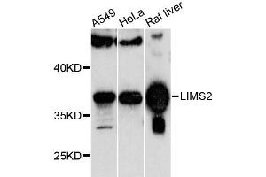 Western blot analysis of extracts of various cell lines, using LIMS2 antibody (ABIN6293255) at 1:1000 dilution. (LIMS2 anticorps)