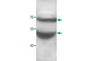 Western blot analysis of human fetal brain lysate with ADAMTS5 polyclonal antibody  at 1 : 500 dilution.