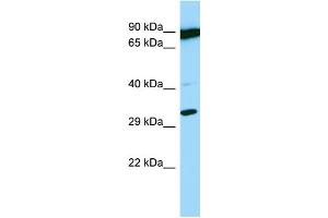 Host: Rabbit Target Name: PSMB11 Sample Type: OVCAR-3 Whole Cell lysates Antibody Dilution: 1. (PSMB11 anticorps  (C-Term))