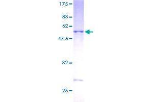 SDS-PAGE (SDS) image for DnaJ (Hsp40) Homolog, Subfamily C, Member 27 (DNAJC27) (AA 1-273) protein (GST tag) (ABIN1351812)