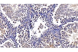 Detection of DDX58 in Mouse Testis Tissue using Polyclonal Antibody to Probable ATP-dependent RNA Helicase DDX58 (DDX58) (DDX58 anticorps  (AA 1-211))