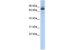 WB Suggested Anti-C14orf21 Antibody Titration:  0. (C14orf21 anticorps  (Middle Region))