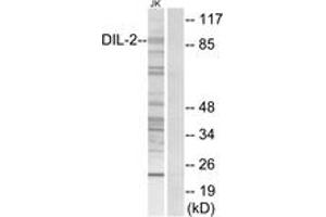 Western blot analysis of extracts from Jurkat cells, using DIL-2 Antibody. (TPX2 anticorps  (AA 301-350))