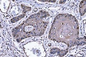 IHC analysis of p57 Kip2/CDKN1C using anti-p57 Kip2/CDKN1C antibody (ABIN7603232). (CDKN1C anticorps  (N-Term))
