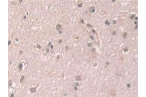 Detection of GCA in Human Cerebrum Tissue using Polyclonal Antibody to Grancalcin (GCA)