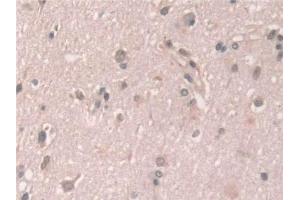 Detection of GCA in Human Cerebrum Tissue using Polyclonal Antibody to Grancalcin (GCA) (Grancalcin anticorps  (AA 1-139))