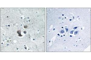 Immunohistochemistry analysis of paraffin-embedded human brain tissue, using IBP7 Antibody. (IGFBP7 anticorps  (AA 191-240))