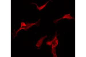 ABIN6267702 staining NIH-3T3 by IF/ICC. (CAMK2B anticorps  (pThr286))