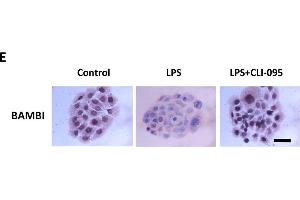 Functional activation of the LPS/TLR4 axis mediates BAMBI downregulation. (BAMBI anticorps  (AA 101-200))