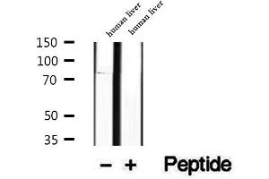 Western blot analysis of extracts of human liver tissue, using P3H3 antibody. (LEPREL2 anticorps  (Internal Region))