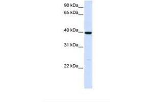 Image no. 1 for anti-Alcohol Dehydrogenase 1A (Class I), alpha Polypeptide (ADH1A) (AA 110-159) antibody (ABIN6738000) (ADH1A anticorps  (AA 110-159))