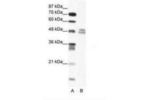Image no. 1 for anti-Thyroid Hormone Receptor Interactor 13 (TRIP13) (AA 83-132) antibody (ABIN202513) (TRIP13 anticorps  (AA 83-132))