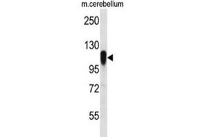 Western Blotting (WB) image for anti-F-Box Protein 41 (FBXO41) antibody (ABIN2996836) (FBXO41 anticorps)