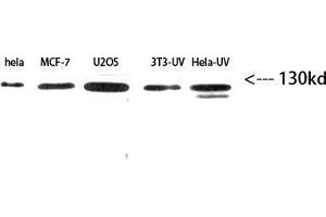 Western Blot (WB) analysis of HeLe,MCF7,U2OS,3T3-UV,HeLa-UV using Integrin β3 Polyclonal Antibody diluted at 1:2000