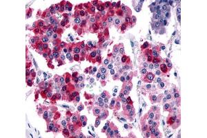 Anti-SSTR4 antibody  ABIN1049364 IHC staining of human pancreas, islet of Langerhans. (SSTR4 anticorps  (N-Term))