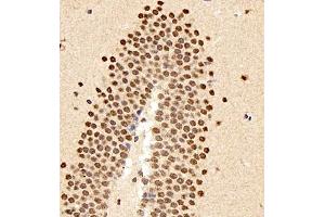 Immunohistochemistry of paraffin embedded mouse brain using smad62024 (ABIN7075629) at dilution of 1:1500 (400x lens)