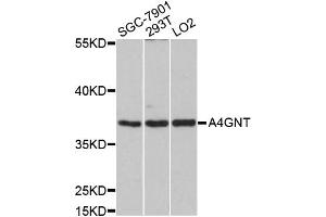 Western blot analysis of extracts of various cell lines, using A4GNT antibody (ABIN5997161) at 1/1000 dilution. (A4GNT anticorps)