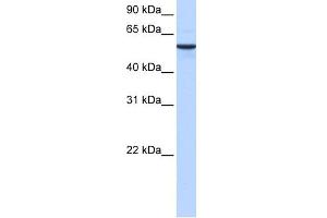 WB Suggested Anti-DPH2 Antibody Titration: 0. (DPH2 anticorps  (N-Term))