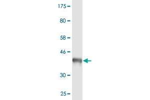 Western Blot detection against Immunogen (37.