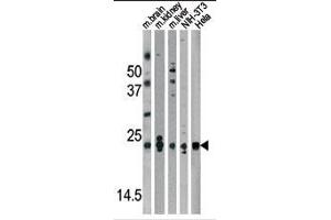 Western blot analysis of anti-Park7 (DJ-1) Antibody (N-term) in mouse brain,kidney,liver tissue lysates and NIH-3T3, Hela cell line lysates (35ug/lane). (PARK7/DJ1 anticorps  (N-Term))