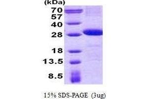 Figure annotation denotes ug of protein loaded and % gel used. (CD226 Protein (CD226))