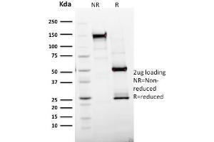 SDS-PAGE Analysis Purified Ki67 Mouse Monoclonal Antibody (MKI67/2465). (Ki-67 anticorps  (AA 2293-2478))