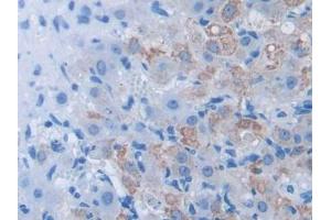IHC-P analysis of Mouse Ovary Tissue, with DAB staining. (BDNF anticorps  (AA 139-249))