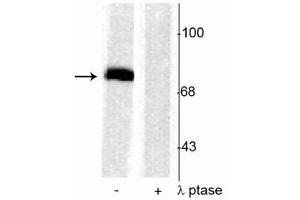 Western blot of rat cortical lysate showing specific immunolabeling of the ~78 kDa synapsin I phosphorylated at Ser603 in the first lane (-). (SYN1 anticorps  (pSer603))