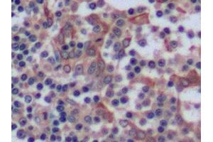 Detection of CK8 in Human Tonsil Tissue using Polyclonal Antibody to Cytokeratin 8 (CK8)