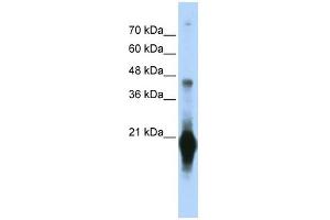 C17ORF49 antibody used at 1 ug/ml to detect target protein. (C17orf49 anticorps  (Middle Region))