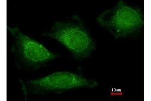 Immunofluorescence analysis of methanol-fixed HeLa, using DNA polymerase gamma antibody at 1:200 dilution. (POLG anticorps  (AA 829-1201))
