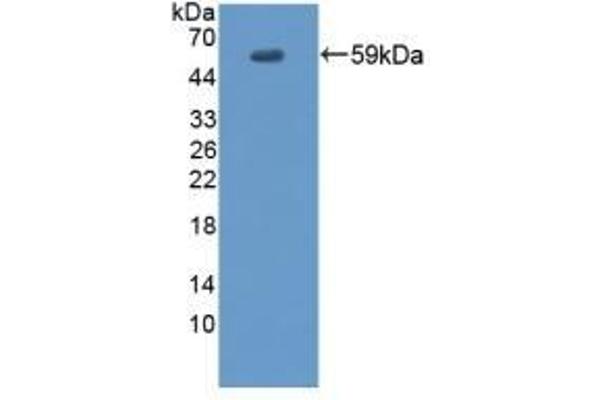 Envoplakin antibody  (AA 3-258)