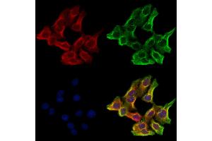 ABIN6265743 and ABIN6273181 staining Hela cells by IF/ICC. (TRIM9 anticorps  (N-Term))
