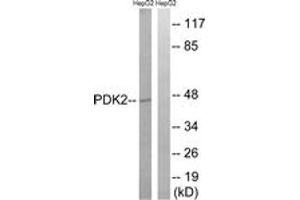Western blot analysis of extracts from HepG2 cells, using PDK2 Antibody. (PDK2 anticorps  (AA 260-309))