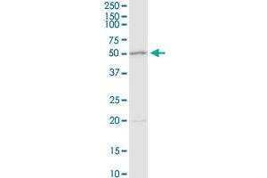 ADA MaxPab rabbit polyclonal antibody. (ADA anticorps  (AA 1-363))