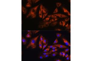 Immunofluorescence analysis of H9C2 cells using  Rabbit pAb (ABIN1678800, ABIN3019073, ABIN3019074 and ABIN6220701) at dilution of 1:100. (Ataxin 10 anticorps  (AA 346-475))