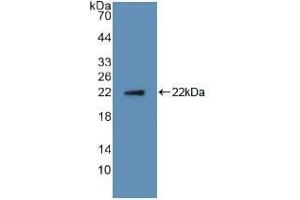 Western blot analysis of recombinant Human RANkL. (RANKL anticorps  (AA 79-247))
